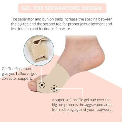 Toe_Bunion_Corrector_Gallery_Img6-min